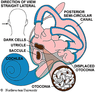 physiotherapy and BPPV